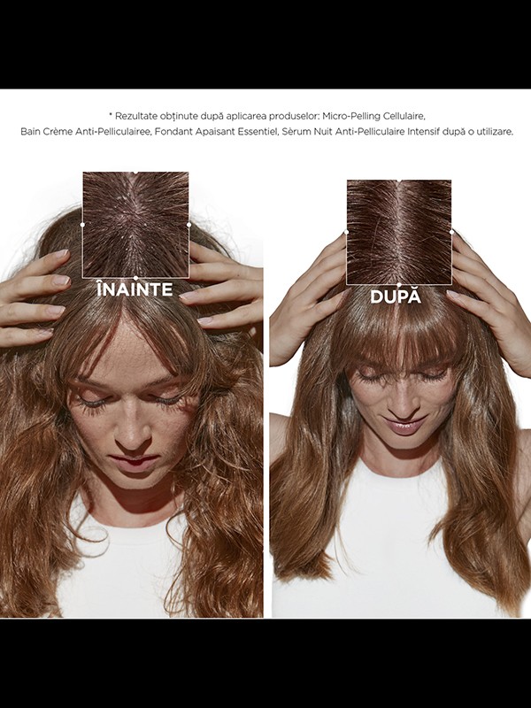 Masca de par anti matreata Kerastase Symbiose